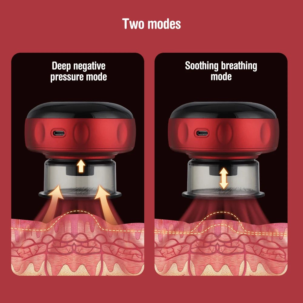 Revolutionary Smart Electric Vacuum Cupping Massager with Heating & Suction for Ultimate Body Relief