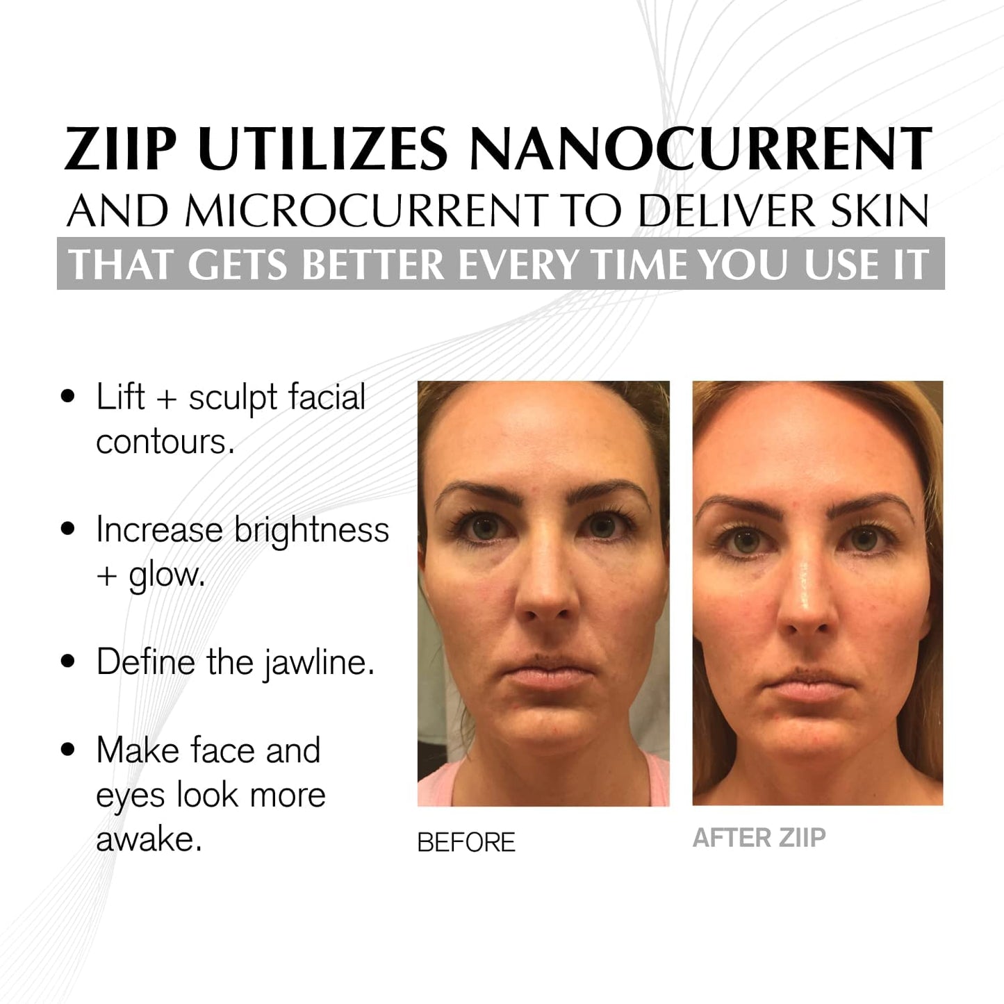 Unlock Radiant Skin: OX Microcurrent Facial Device with Organic Crystal Gel for Home Sculpting, Lifting & Contouring!