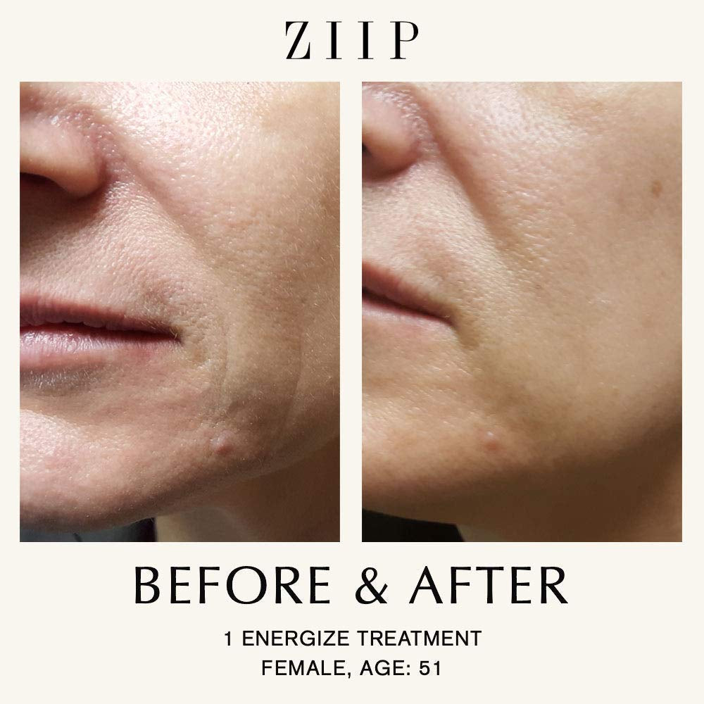 Unlock Radiant Skin: OX Microcurrent Facial Device with Organic Crystal Gel for Home Sculpting, Lifting & Contouring!
