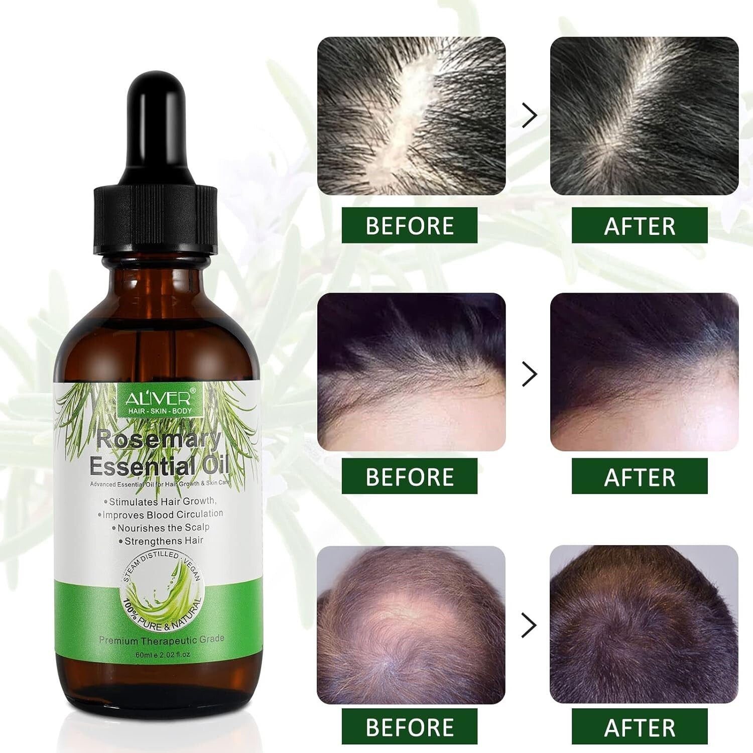 Rosemary Essential Oil for Hair Growth, Pure and Natural, Perfect for Aromathera